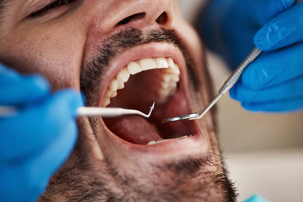 Best Emergency Dental Services Near Me  in Macarthur, WV