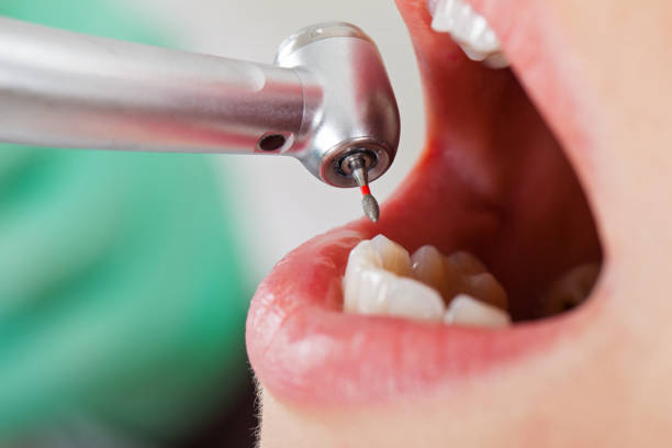 Best Knocked-Out Tooth Emergency  in Macarthur, WV
